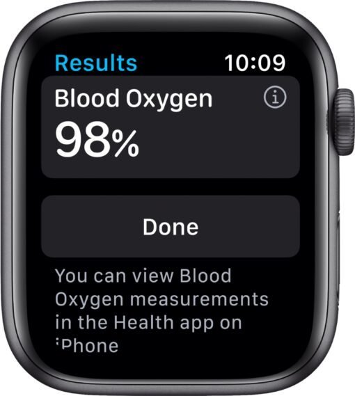 Apple Watch Wholesale Pallets - Image 30