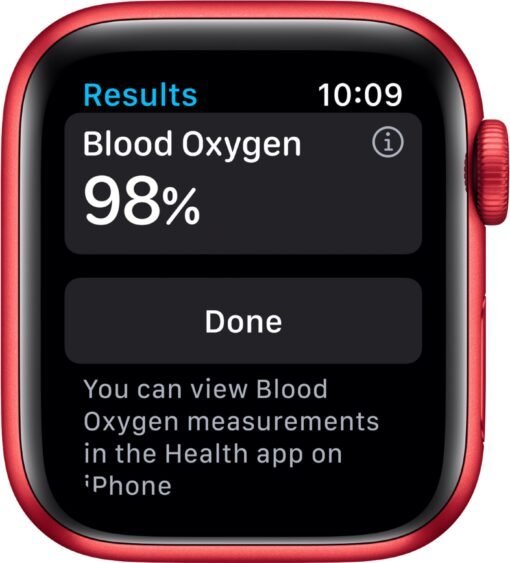 Apple Watch Wholesale Pallets - Image 27